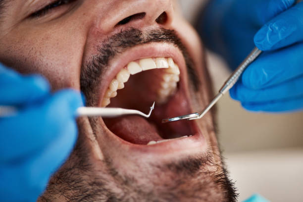 Best Emergency Dental Care for Abscessed Tooth in Long Beach, WA